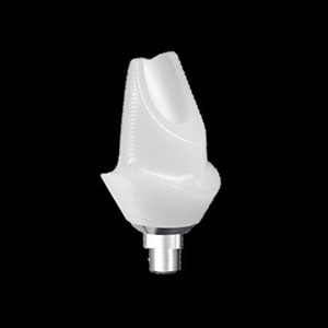 Custom Abutment Fort Worth