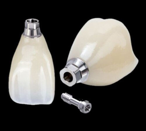 Fort Worth Digital Dental Laboratory